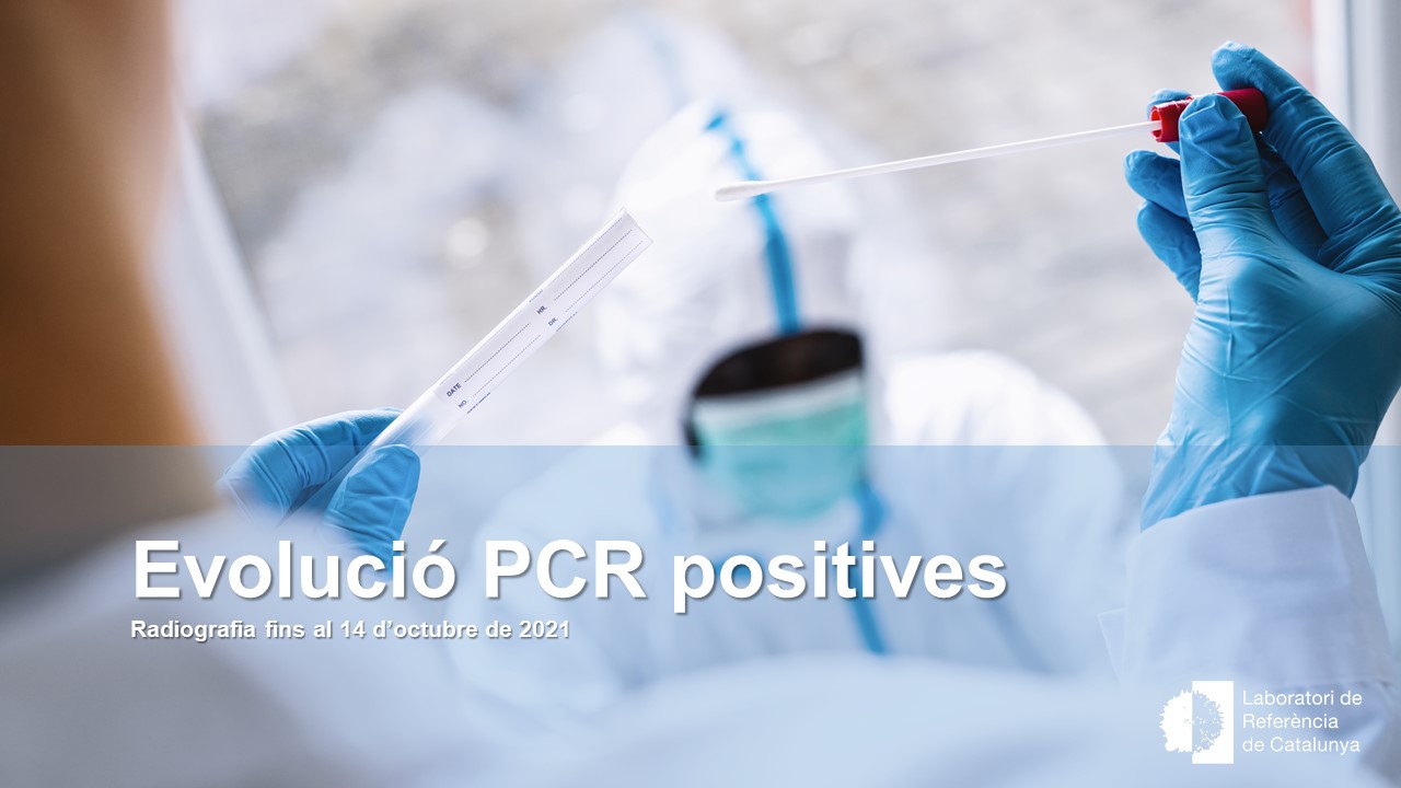 Actualizamos la situación de la red: volumen de PCR y positivos por edad