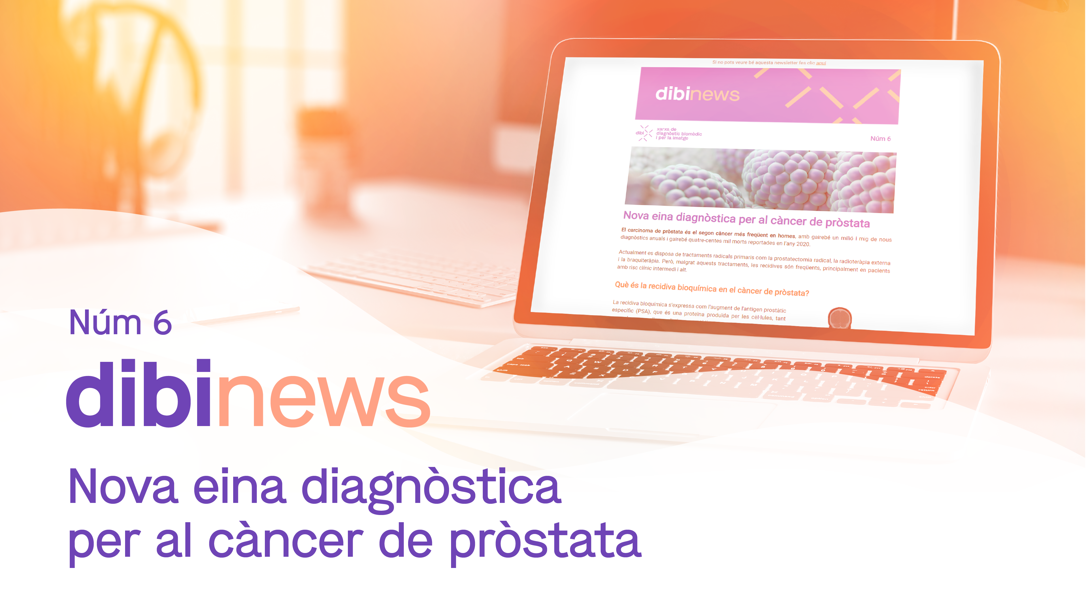 dibinews núm. 6 · Nueva herramienta diagnóstica para el cáncer de próstata