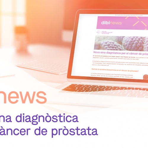 dibinews núm. 6 · Nova eina diagnòstica per al càncer de pròstata