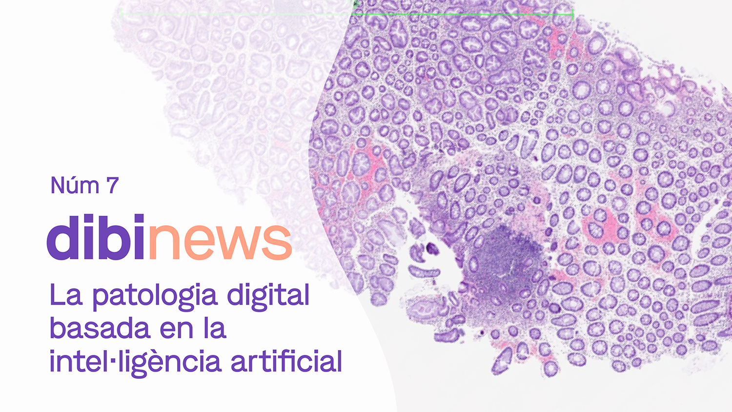 dibinews núm. 7 ·  La patología digital basada en la inteligencia artificial