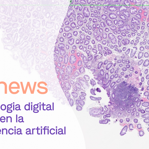 dibinews núm. 7 ·  La patología digital basada en la inteligencia artificial
