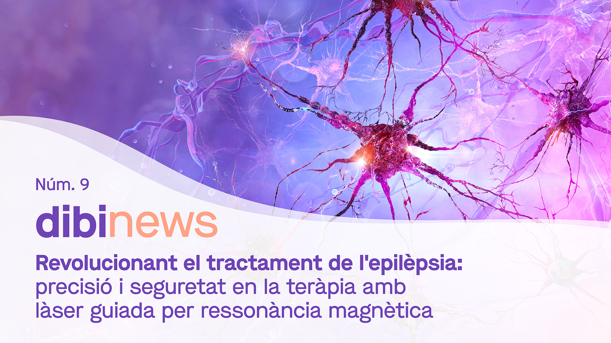 dibinews núm. 9 · Revolucionando el tratamiento de la epilepsia